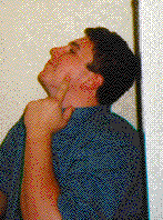 Marc pointing to his cheek